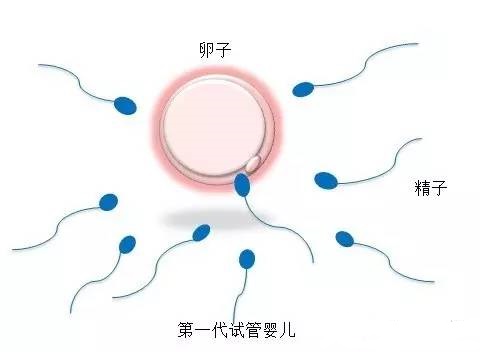 全球医疗